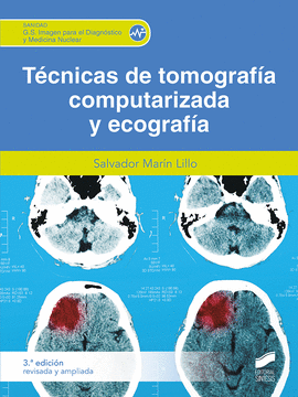 T�CNICAS DE TOMOGRAF�A COMPUTERIZADA (3.� EDICI�N REVISADA Y AMPLIADA)