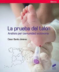 PRUEBA DEL TAL�N
