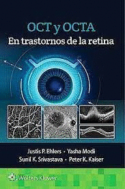 OCT Y OCTA EN TRASTORNOS DE LA RETINA