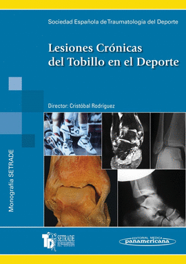 LESIONES CR�NICAS DEL TOBILLO EN EL DEPORTE