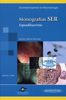 MONOGRAFIA SER: ESPONDILOARTRITIS