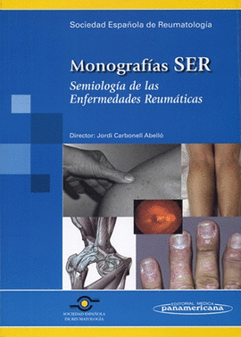 MONOGRAFIAS SER: SEMIOLOGIA DE LAS ENFERMEDADES REUMATICAS