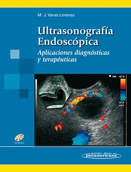 ULTRASONOGRAF�A ENDOSC�PICA