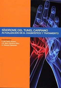 SINDROME DE TUNEL CARPIANO