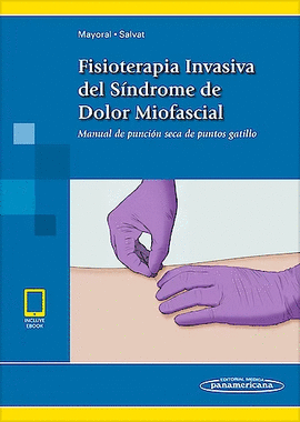 FISIOTERAPIA INVASIVA DEL S�NDROME DE DOLOR MIOFASCIAL