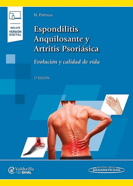 ESPONDILITIS ANQUILOSANTE Y ARTRITIS PSORI�SICA