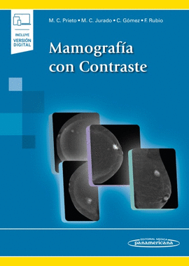 MAMOGRAF�A CON CONTRASTE (+EBOOK)
