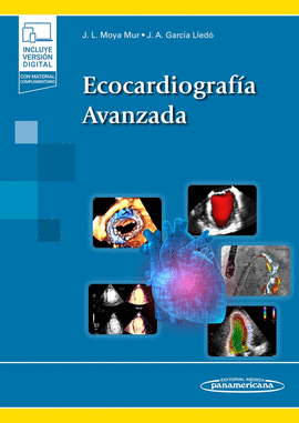 ECOCARDIOGRAFA AVANZADA + E-BOOK