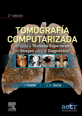 TOMOGRAFA COMPUTERIZADA