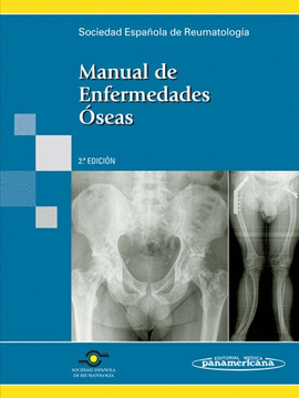 MANUAL ENFERMEDADES OSEAS
