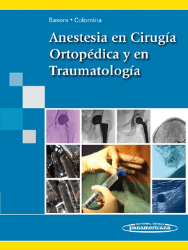 ANESTESIA EN CIRUG�A ORTOP�DICA Y EN TRAUMATOLOG�A