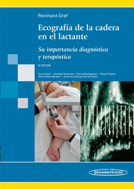 ECOGRAFIA CADERA EN LACTANTE 6AED