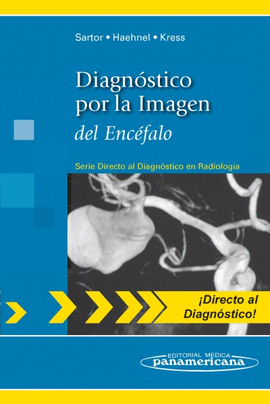 DIAGN�STICO POR LA IMAGEN DEL ENC�FALO (DIRECTO AL DIAGN�STICO EN RADIOLOG�A)