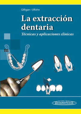 LA EXTRACCI�N DENTARIA. T�CNICAS Y APLICACIONES CL�NICAS
