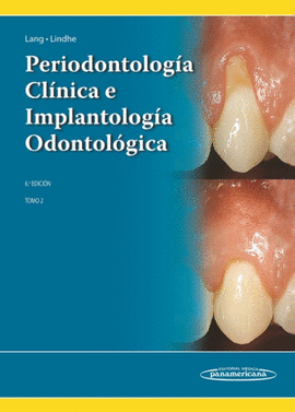 PERIODONTOLOG�A CL�NICA E IMPLANTOLOG�A ODONTOL�GICA