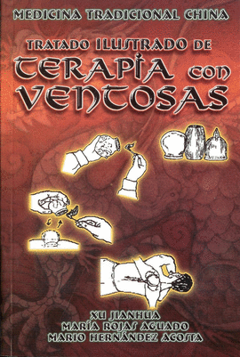 TRATADO ILUSTRADO DE TERAPIA CON VENTOSAS
